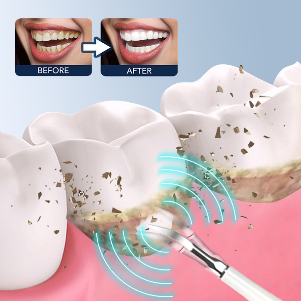 A popular foreign trade product, the six-in-one electric toothbrush set, portable tartar removal, teeth cleaning and beauty device Specification image