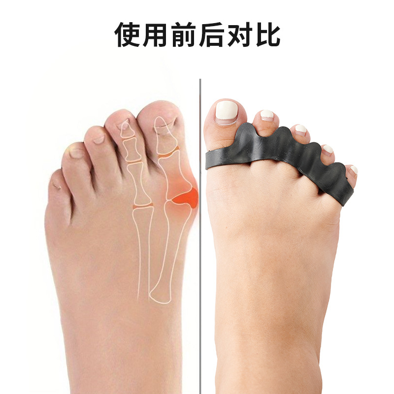 Five-hole toe separator for hallux valgus, big toe bone overlap, toe clamp, orthosis, toe separator pad, adjustable separator Specification image