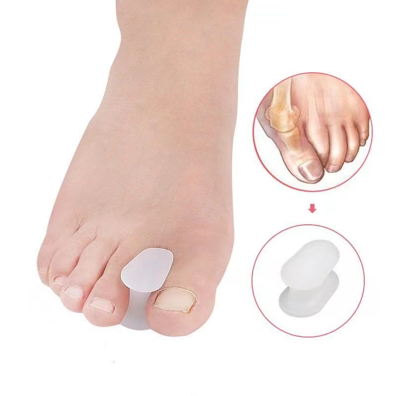 Correction of hallux valgus, toe separation corrector, orthosis, big toe overlap, toe divider, thumb valgus Application Scenario