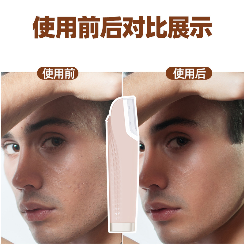 shanilak's new electric hair remover, sonic vibration hair removal knife, shaving knife, dead skin trimmer and wireless hair removal device details Picture