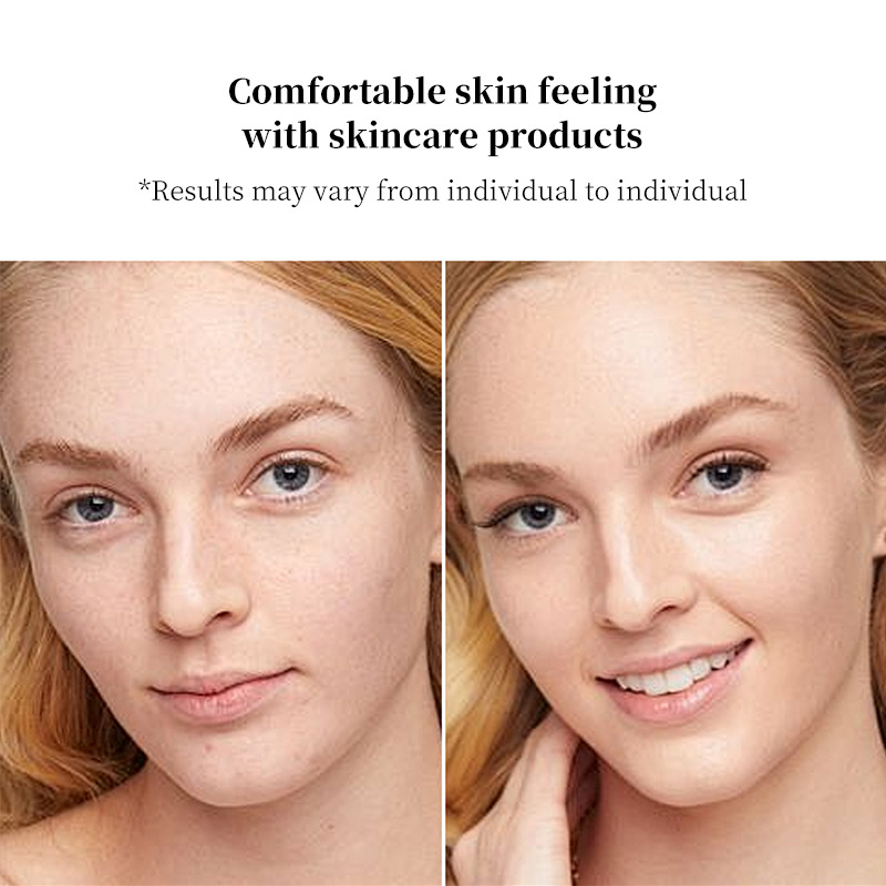 shanilak          新款美眼仪精华导入仪EMS嫩肤微电流导入仪眼部按摩仪护肤