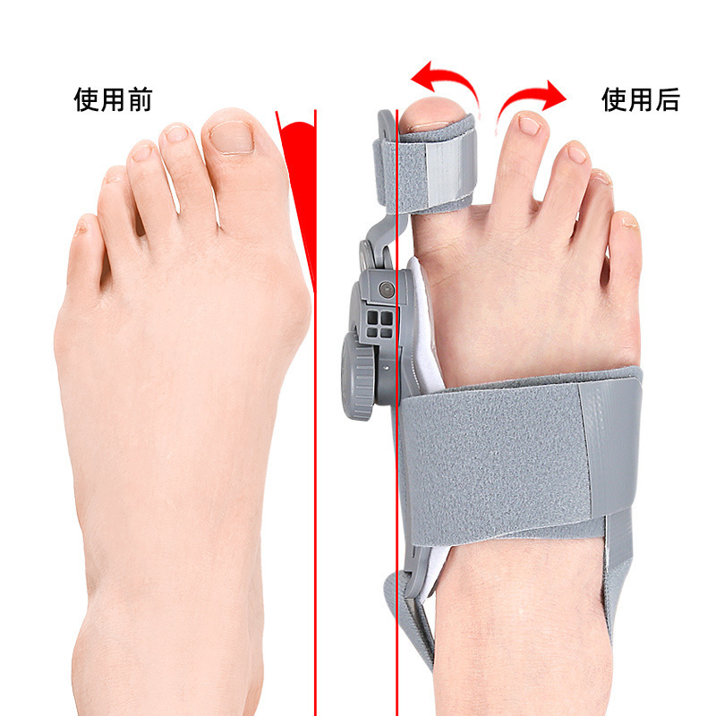 Big toe valgus orthosis, big toe bone separator, day and night adjustable rotating buckle, big toe bone hallux valgus device Specification image