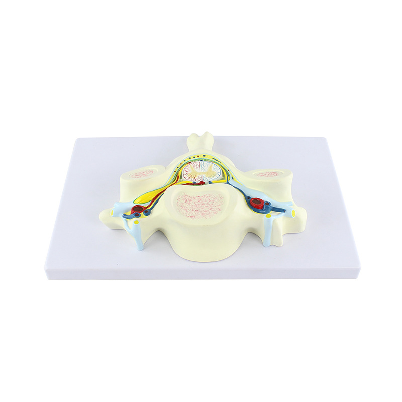 Teaching model of the fifth cervical vertebra with spinal cord and spinal nerve magnification model, medical acupoint teaching supplies Application Scenario