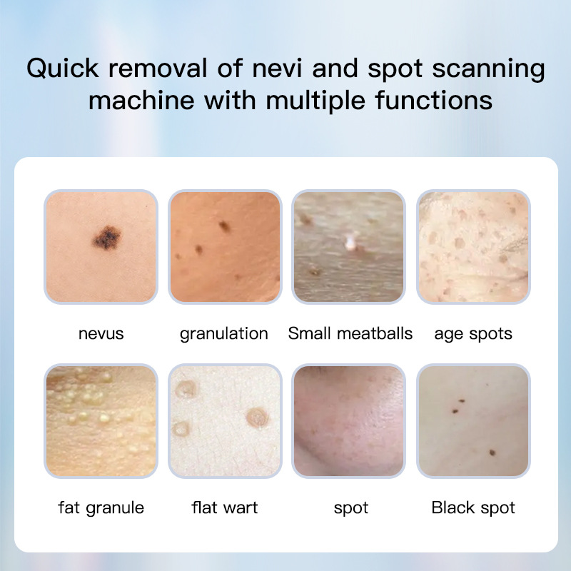 shanilak  跨境多功能液晶红蓝光可调节家用红光蓝光美容笔点斑去斑便携
