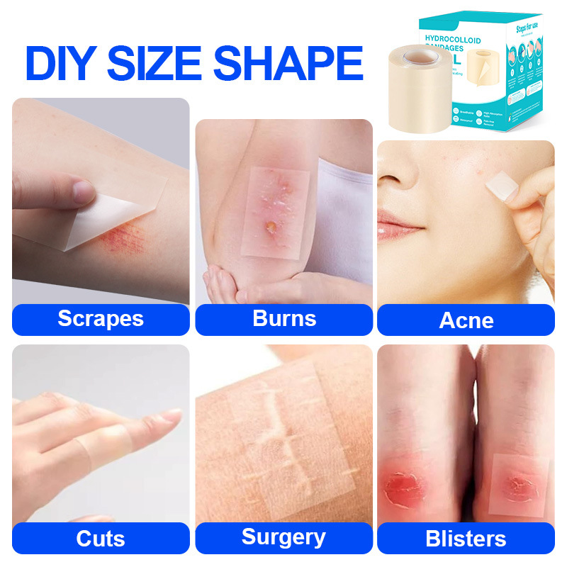 Amazon hydrocolloid roll wound dressing has strong water absorption. It is a hydrocolloid dressing for wet healing of superficial burns with liquid absorption Application Scenario