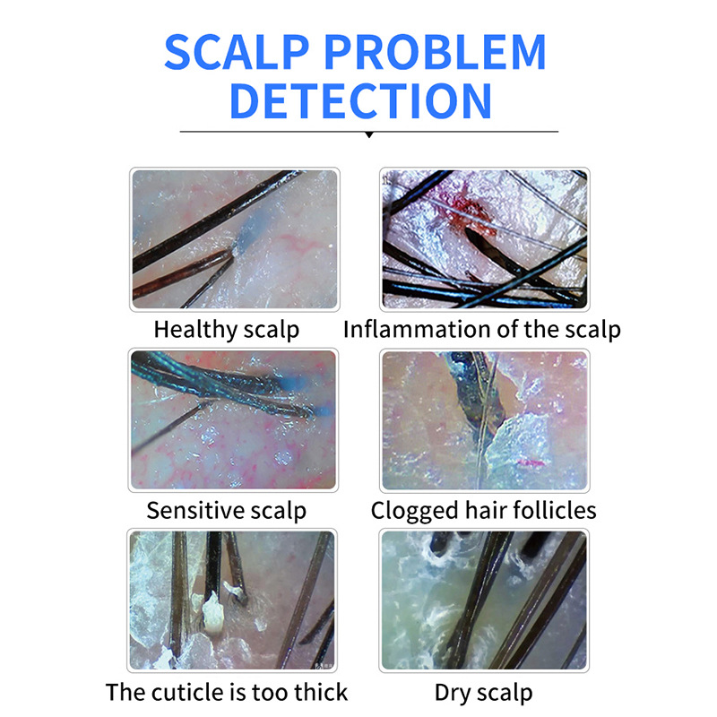 shanilak scalp hair follicle hair detector, skin testing instrument, pore magnifying glass, barber shop, USB connection to mobile phone, high definition Specification image