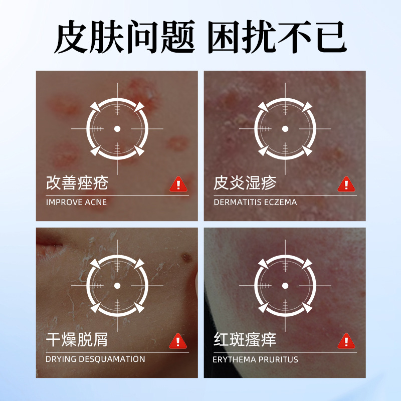 Customized medical skin liquid dressings for acne, dermatitis, eczema, sensitive skin, dryness, desquamation, erythema and itching details Picture