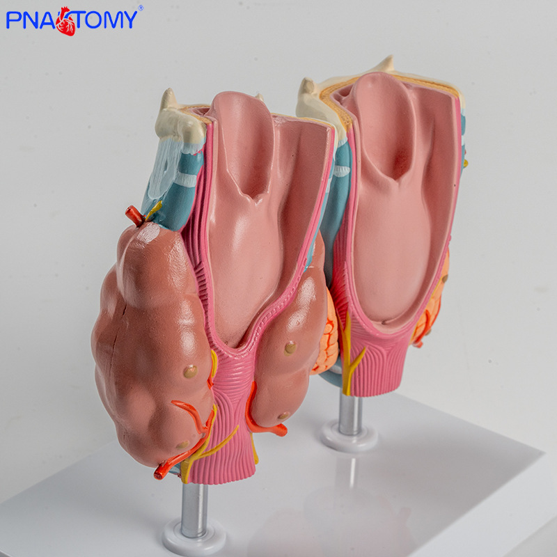 Human pathological thyroid model, hyperthyroidism, hypothyroidism, endocrine system, medical anatomy, thyroid larynx, teaching AIDS Application Scenario
