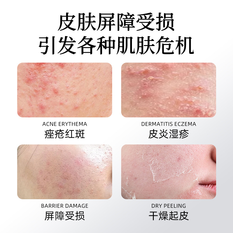 Medical sodium hyaluronate repair patches 25g×5 patches per box details Picture