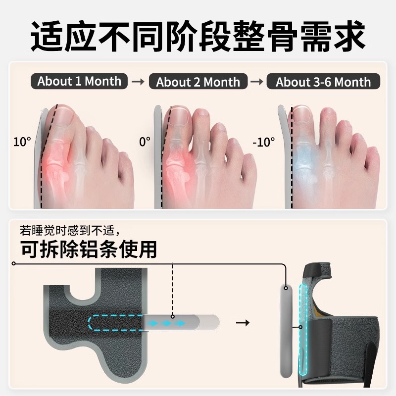 Thumb valgus corrector, male and female toe valgus separator, toe overlap separation, correctional aluminum strip support Application Scenario