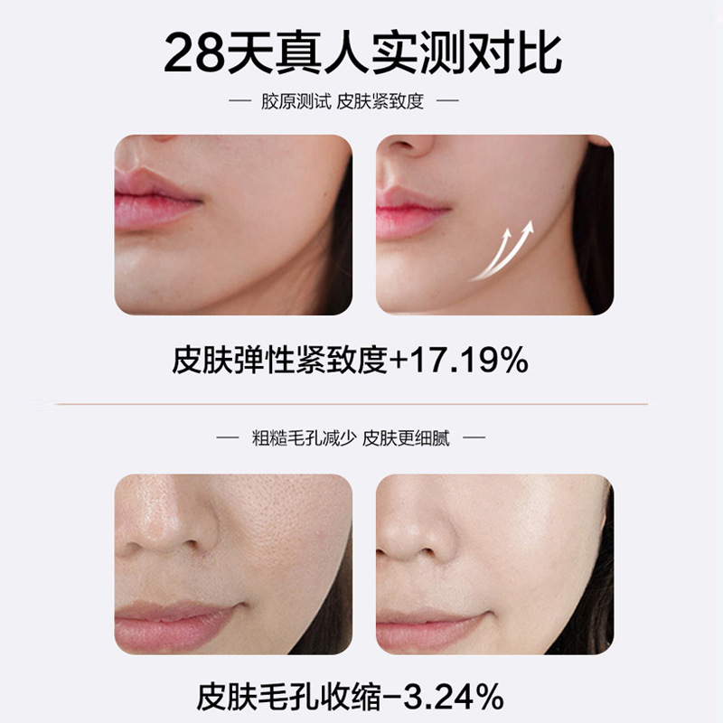 shanilak's new home needle-free water light device, beauty salon microcrystal introduction device, facial beauty device and electric beauty pen details Picture