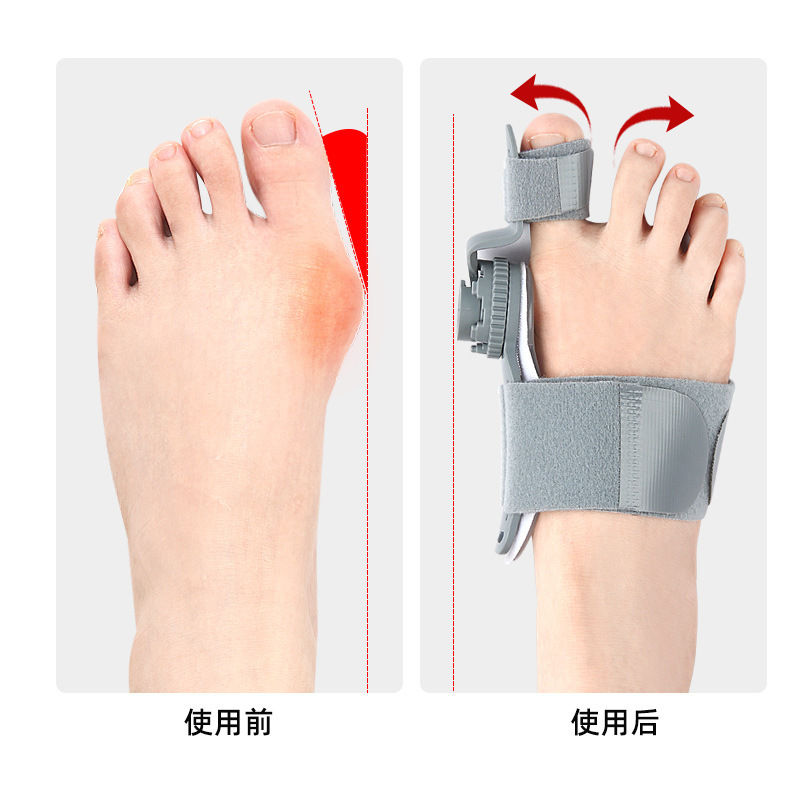 Thumb eversion orthosis, big foot bone protrusion overlapping toe separator, day-night rotatable adjustable orthosis details Picture