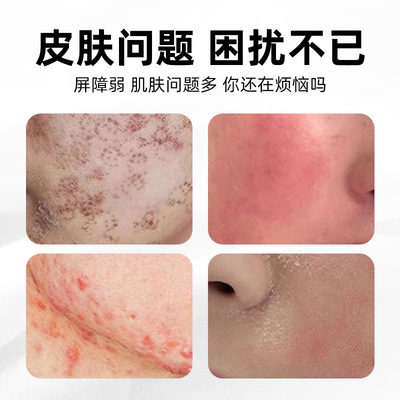 Sodium hyaluronate laser photon fruit acid exchange micro-plastic surgery for moisturizing and reducing swelling of sensitive skin after wounds details Picture