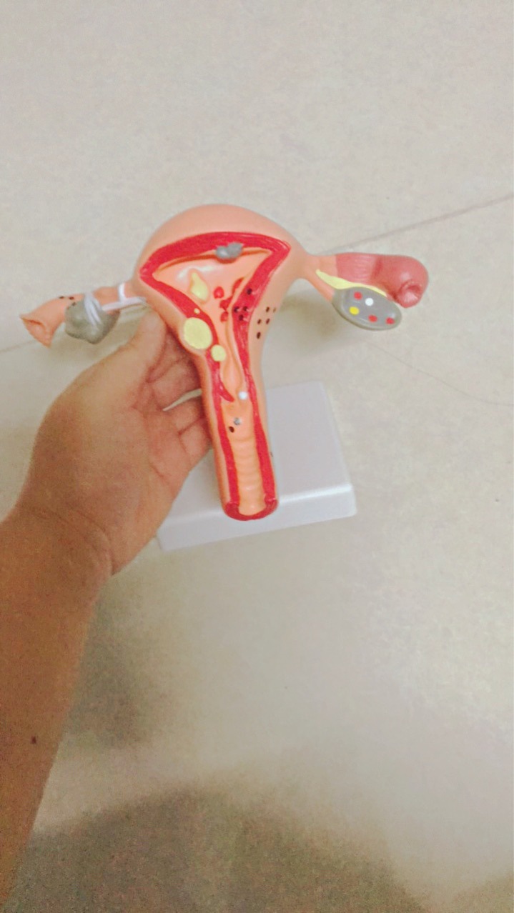 Human uterus model teaching aid mold, ovarian anatomy and pathology, medical, female simulation reproductive mold, medical Specification image