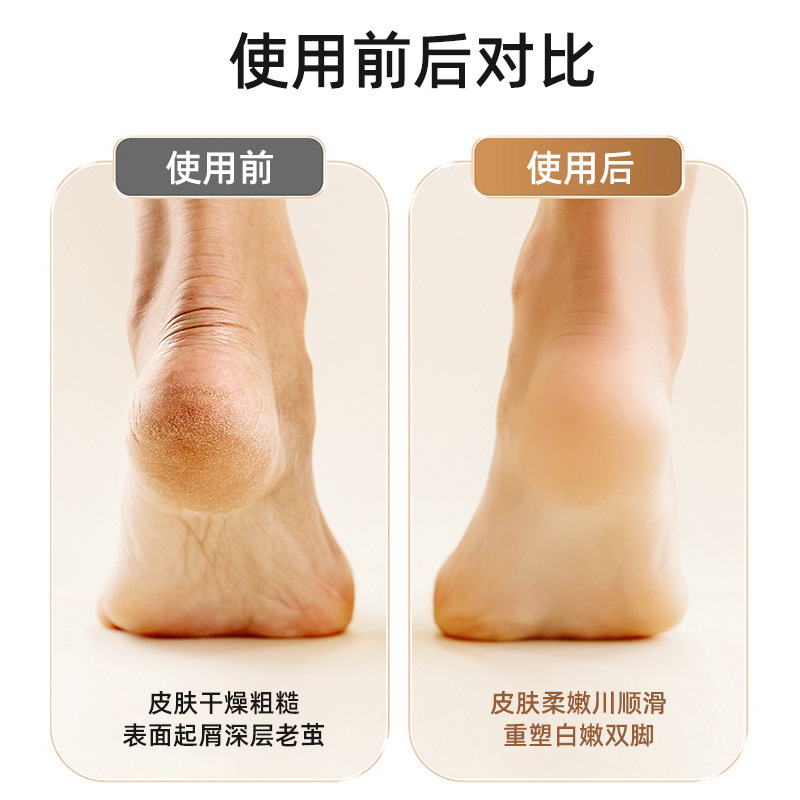 shanilak wireless electric foot masser, cross-border dead skin pedicure device, high-power charging model, multi-speed adjustment, new portable