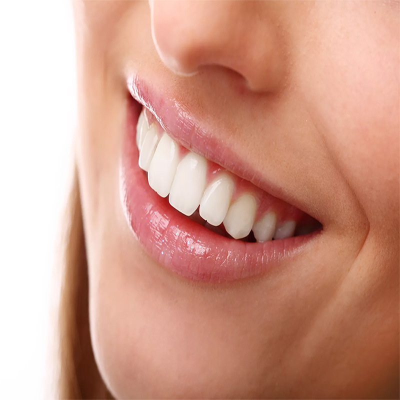 Foreign trade exclusive dental polishing strips, dental materials, interdental resin polishing disc sets, disposable composite polishing discs Application Scenario