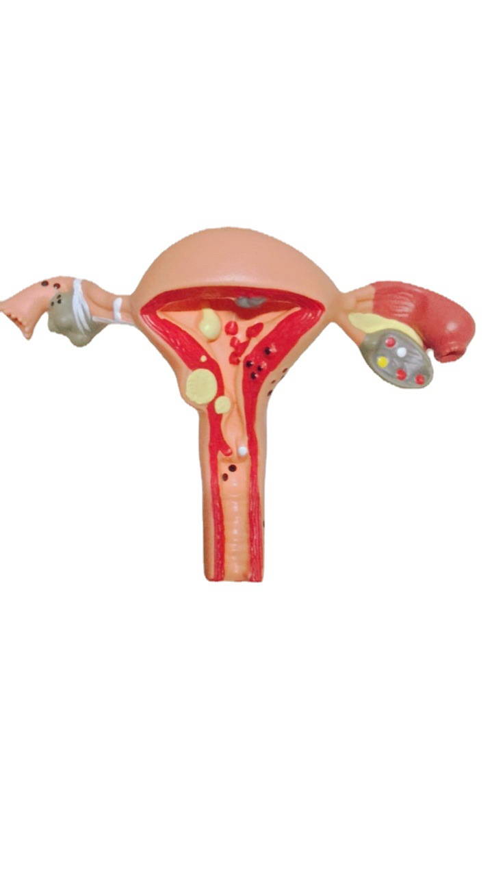 Human uterus model teaching aid mold, ovarian anatomy and pathology, medical, female simulation reproductive mold, medical Application Scenario