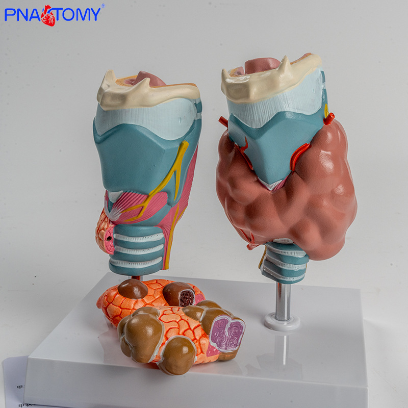 Human pathological thyroid model, hyperthyroidism, hypothyroidism, endocrine system, medical anatomy, thyroid larynx, teaching AIDS Item Picture