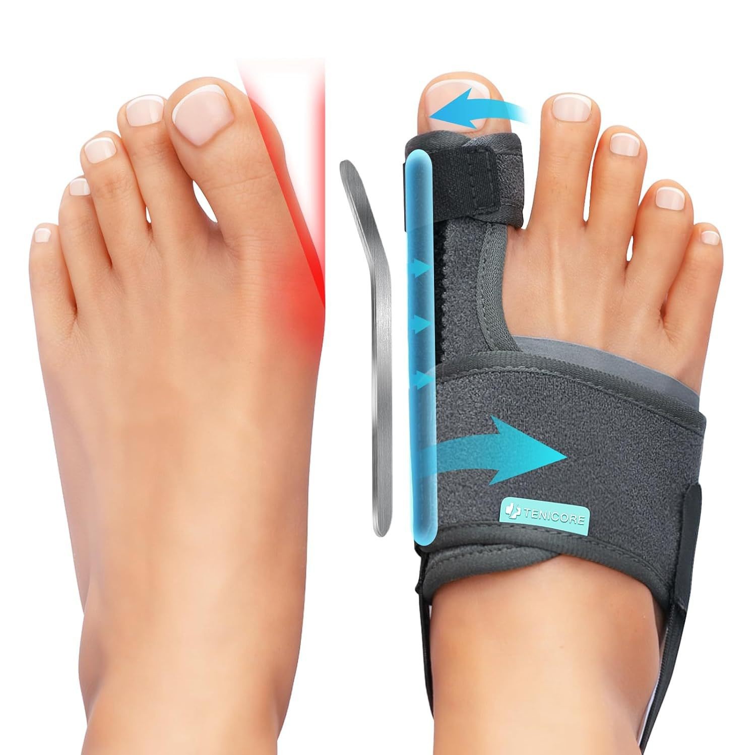 Thumb valgus corrector, male and female toe valgus separator, toe overlap separation, correctional aluminum strip support Item Picture