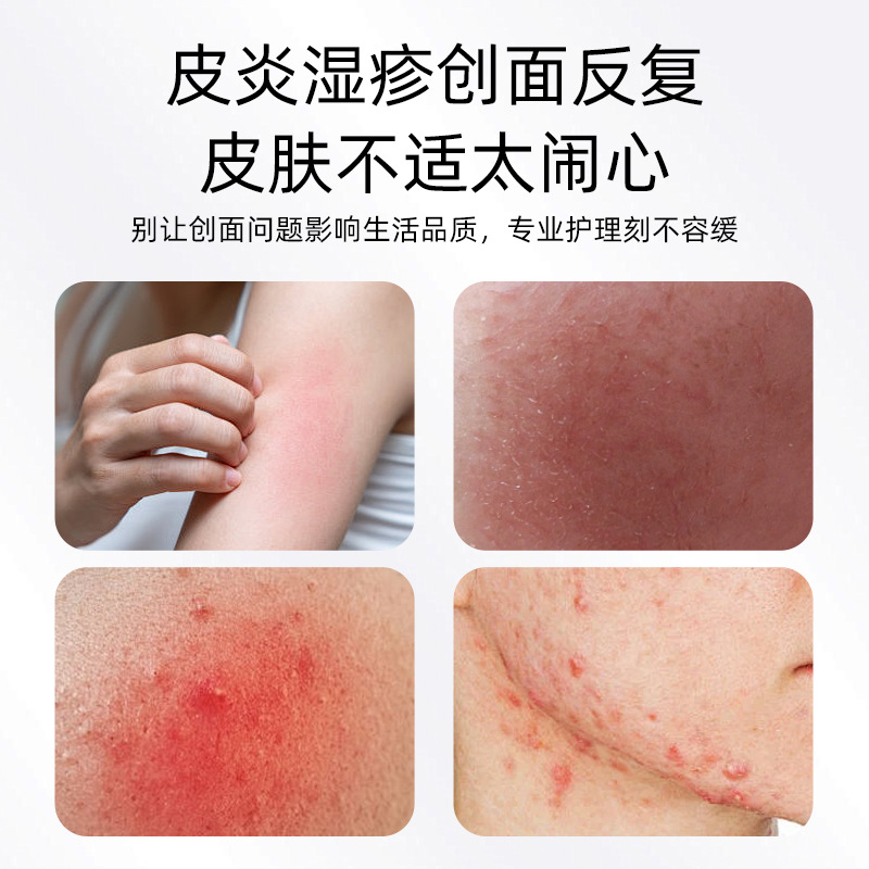 Customized medical recombinant collagen dressing lotion, facial care dressing, moisturizing, dermatitis, eczema repair barrier details Picture