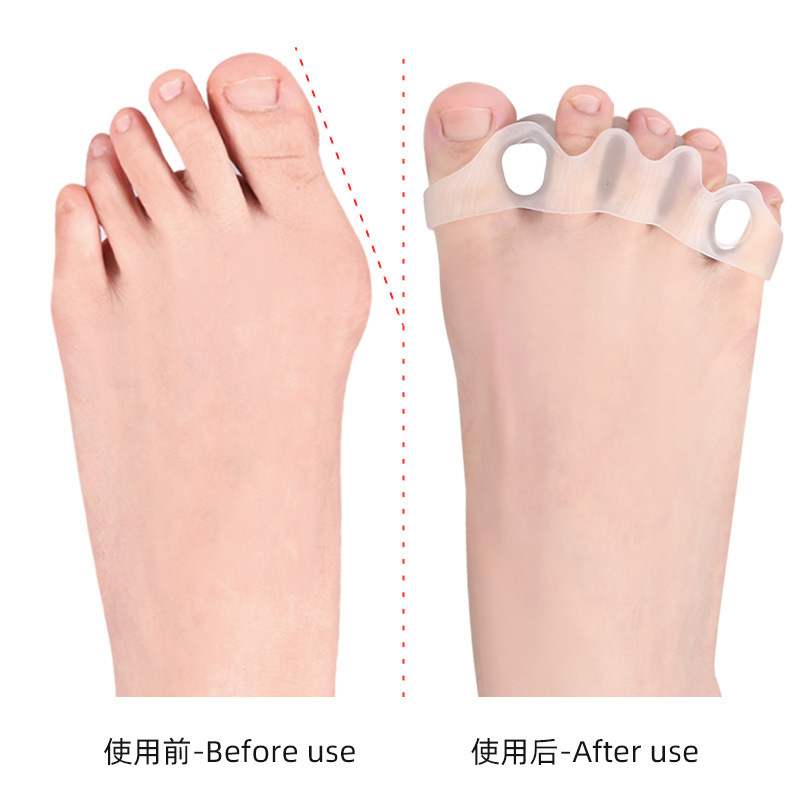 Five-hole toe separator for hallux valgus, bigfoot bone overlapping toe orthosis, detachable sponge plug foot separator details Picture