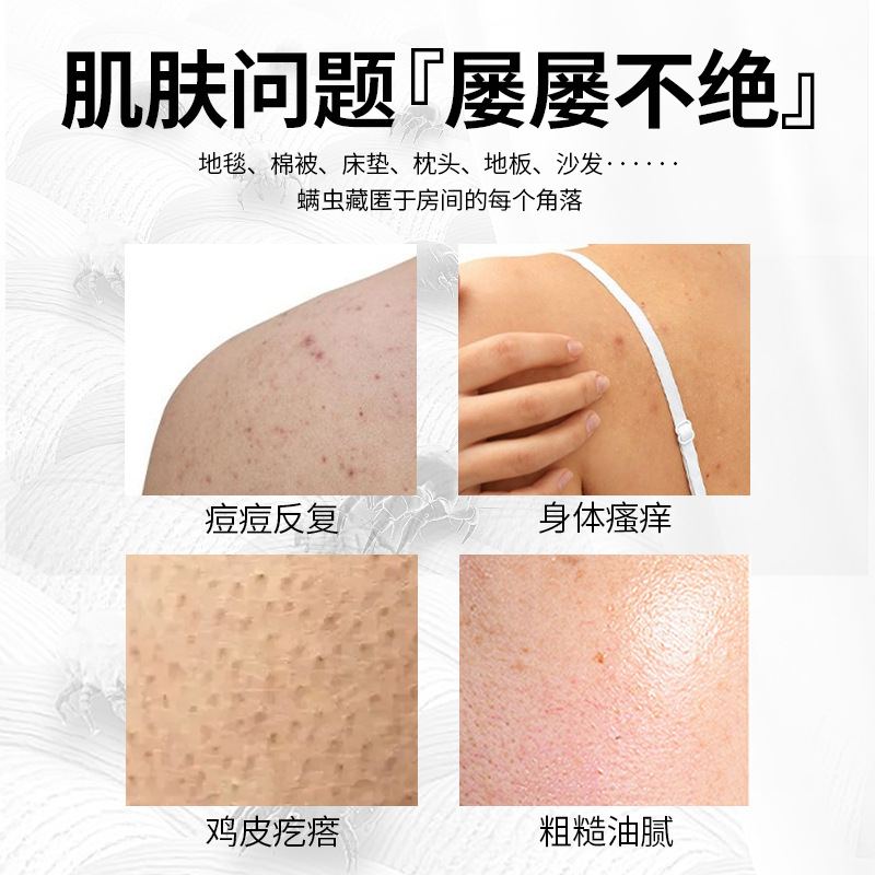 Sulfur liquid soap, household set, sulfur body wash, acne removal face soap, bath moisturizing liquid, mite repellent soap Application Scenario