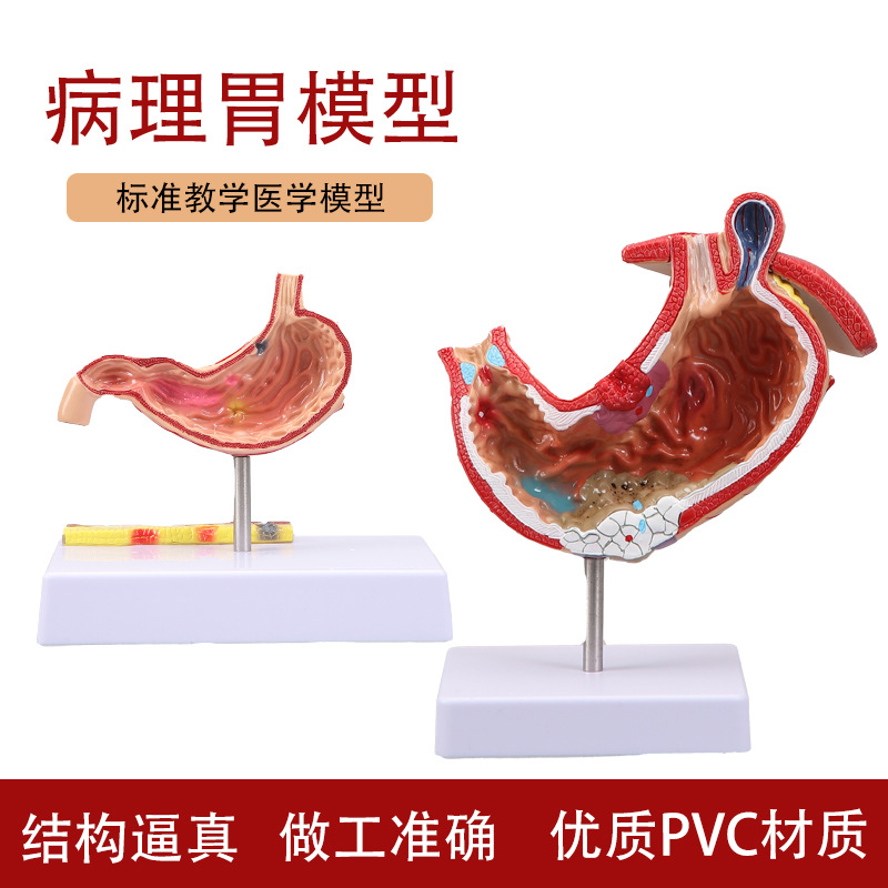 Human stomach anatomy model, traditional Chinese medicine teaching physical object, human stomach structure model, portable demonstration equipment, tuning fork to assist learning details Picture