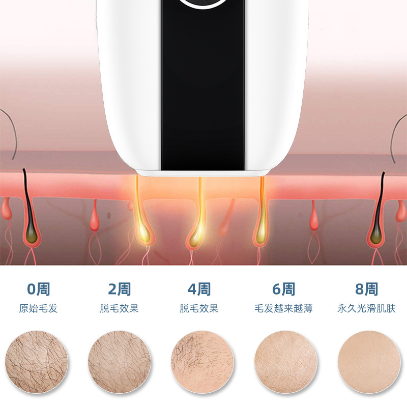shanilak export handheld Ice Point Hair Removal Device, full-body hair removal and shaving device, Private ipl Ice Point Hair Removal device wholesale Application Scenario