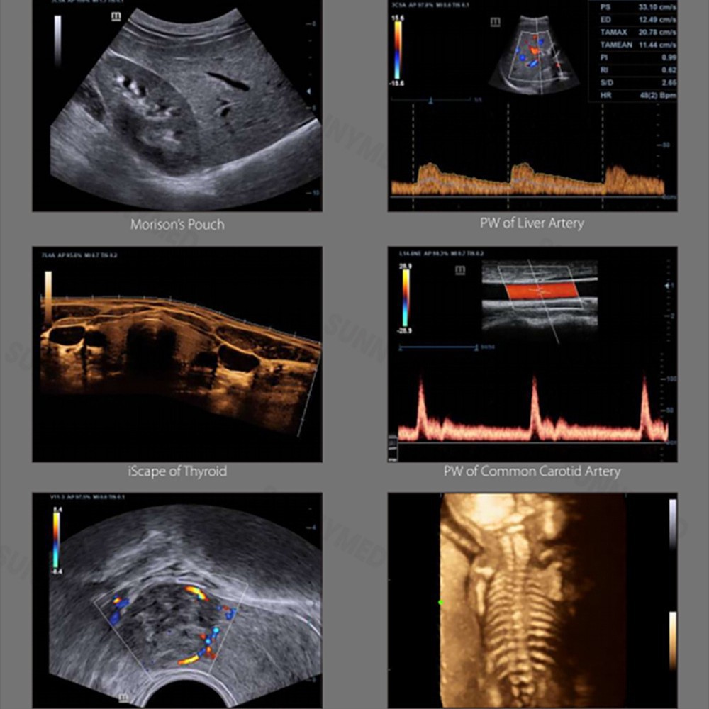 Cross-border exclusive supply Mindray DC-40 color Doppler ultrasound scanner B-ultrasound machine desktop ultrasound diagnostic system details Picture