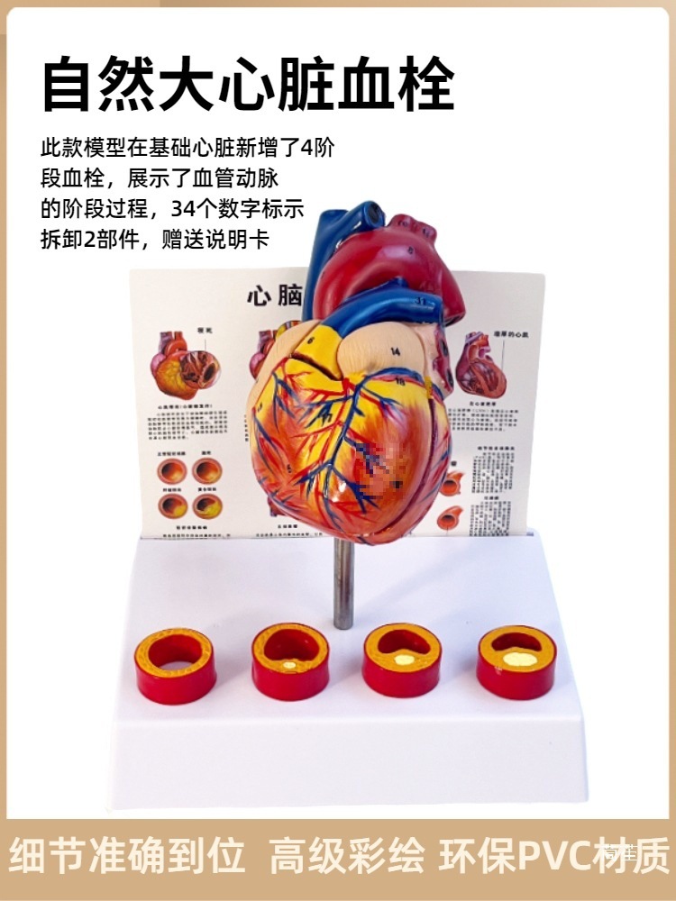 Standard human heart anatomy model B-ultrasound color Doppler ultrasound detachable natural large heart medical teaching aid model details Picture