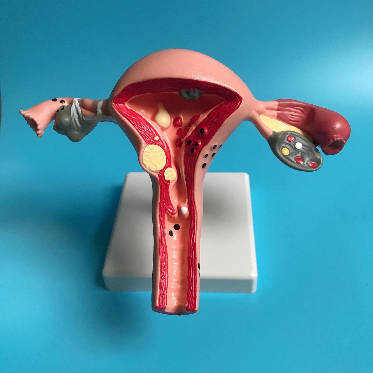 Human uterus model teaching aid mold, ovarian anatomy and pathology, medical, female simulation reproductive mold, medical