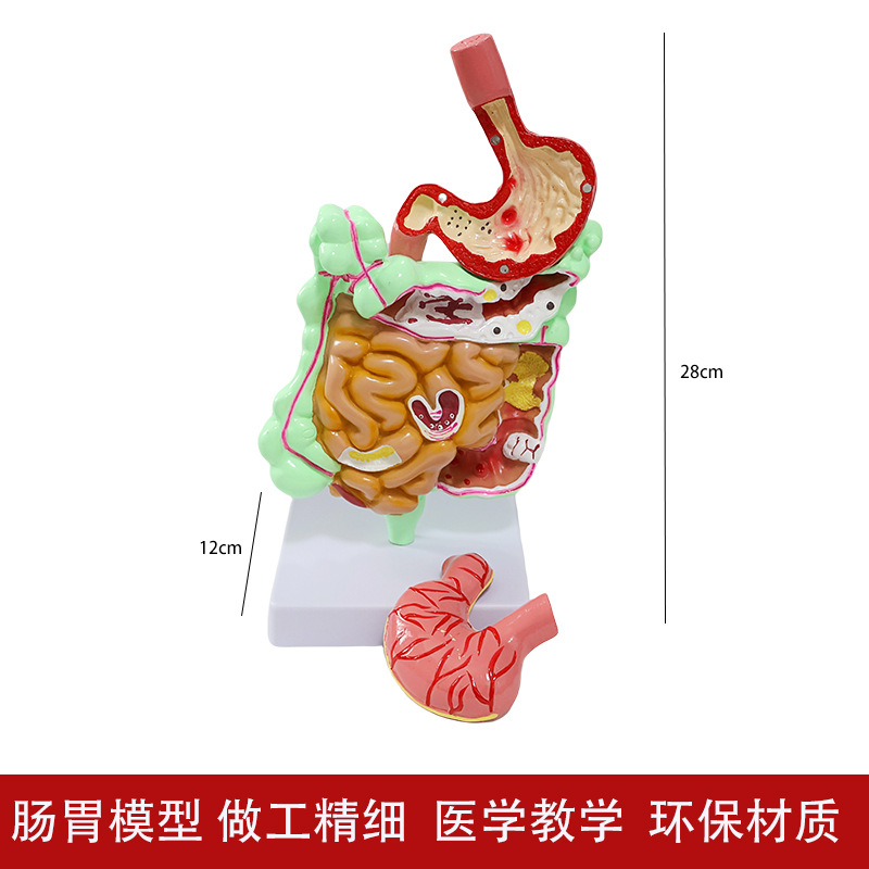 Human stomach anatomy model, traditional Chinese medicine teaching physical object, human stomach structure model, portable demonstration equipment, tuning fork to assist learning Application Scenario