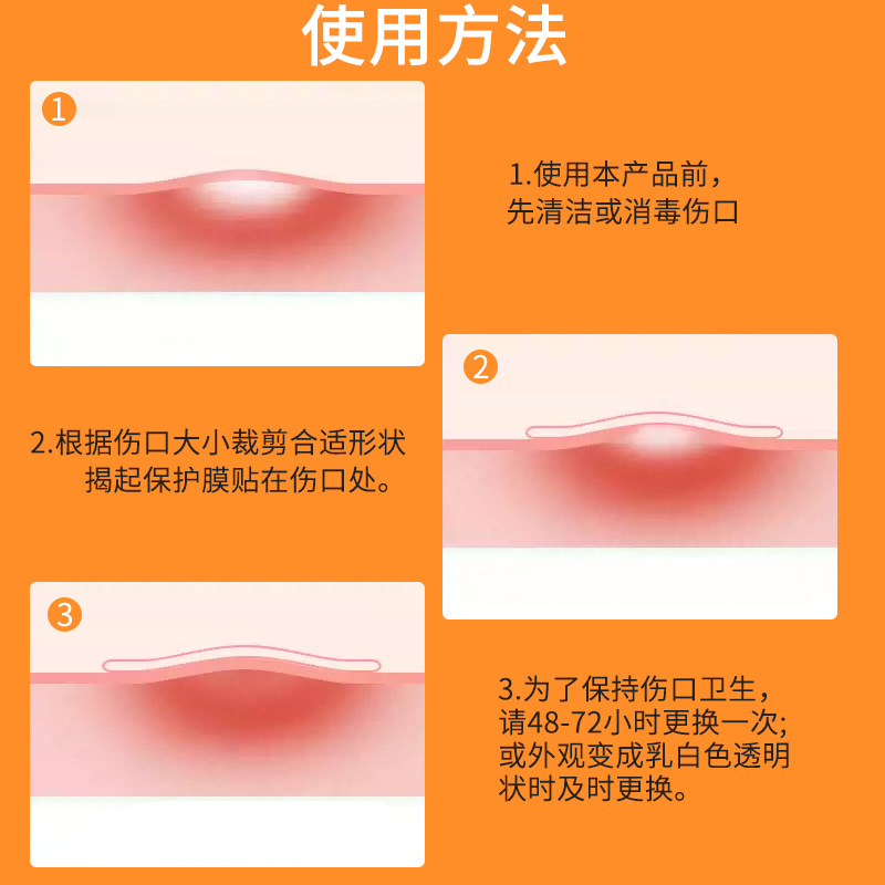 Aoqi Medical ultra-thin hydrocolloid Dressing, artificial skin wound patch, acne patch, acne removal transparent pressure ulcer dressing customization Specification image