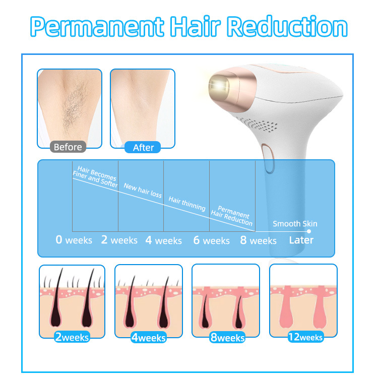 The best-selling ice point laser hair removal device features strong pulse beauty, skin rejuvenation and acne removal. It can be used all over the body and is a painless ice point hair removal device details Picture