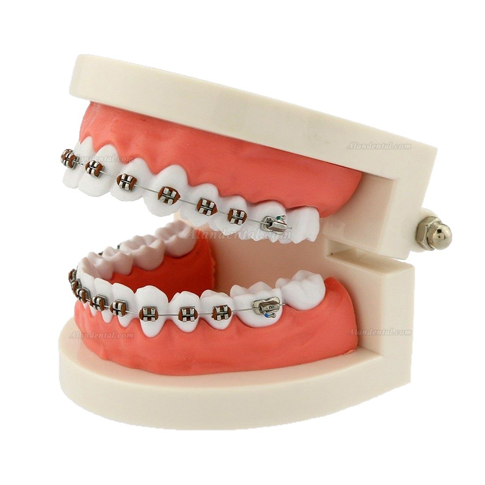 Cross-border exclusive orthodontic models, oral teaching props, color orthodontic models with brackets, dental models Item Picture