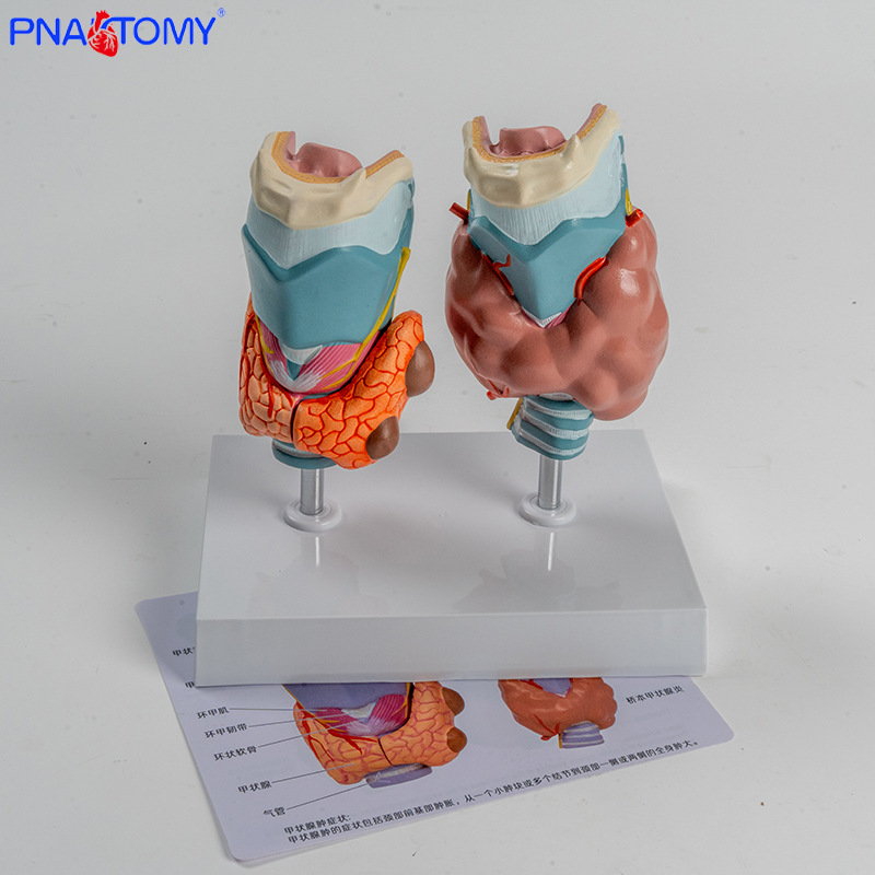 人体病理甲状腺模型甲亢甲低内分泌系统医学解剖甲状腺喉头教具