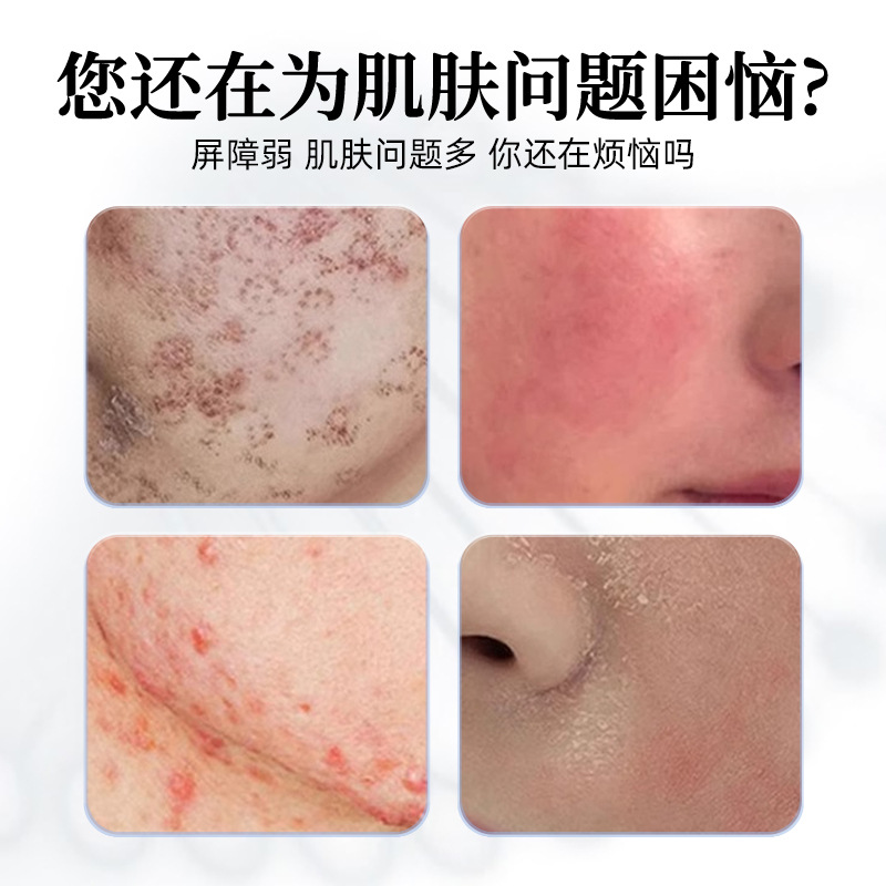 Medical mask Type III collagen moisturizing, acne removal, eczema OEM details Picture