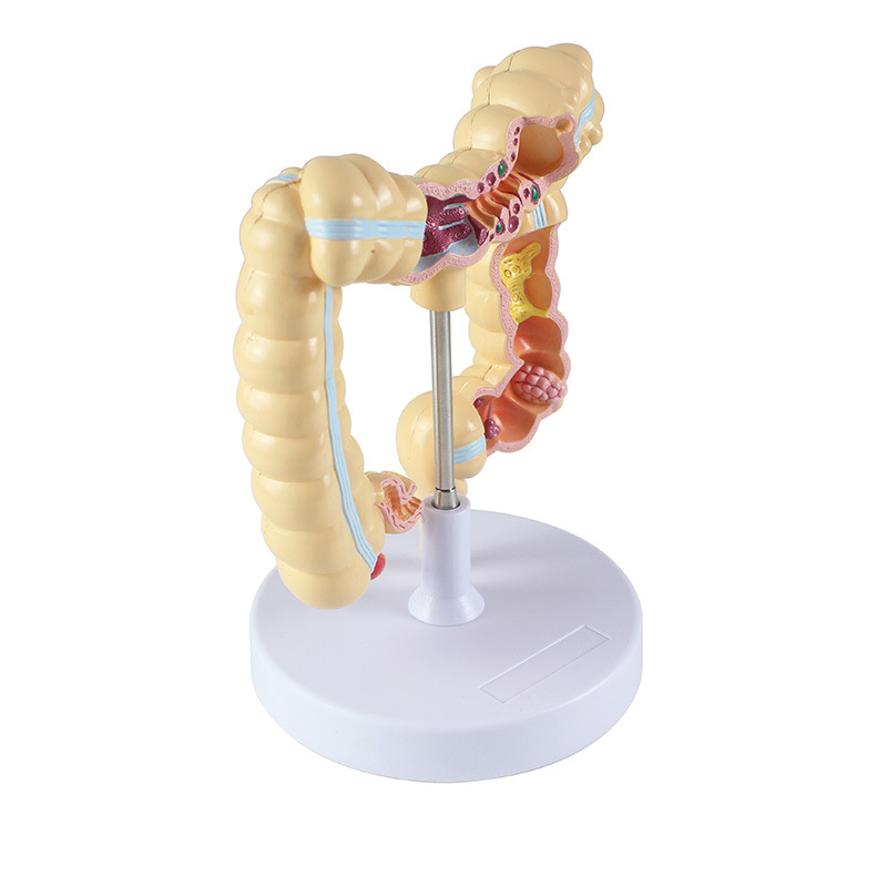 Wholesale of human colon lesion model props for school medical college teaching with high detail reproduction details Picture