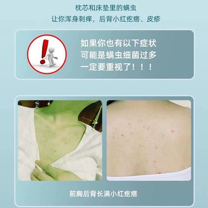 Linglexi Green Pepper Mite Repellent Spray, Bed and quilt household insecticide 蝻 agent, a no-rinse mite removal wonder Specification image