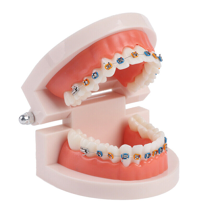 Cross-border exclusive orthodontic models, oral teaching props, color orthodontic models with brackets, dental models details Picture