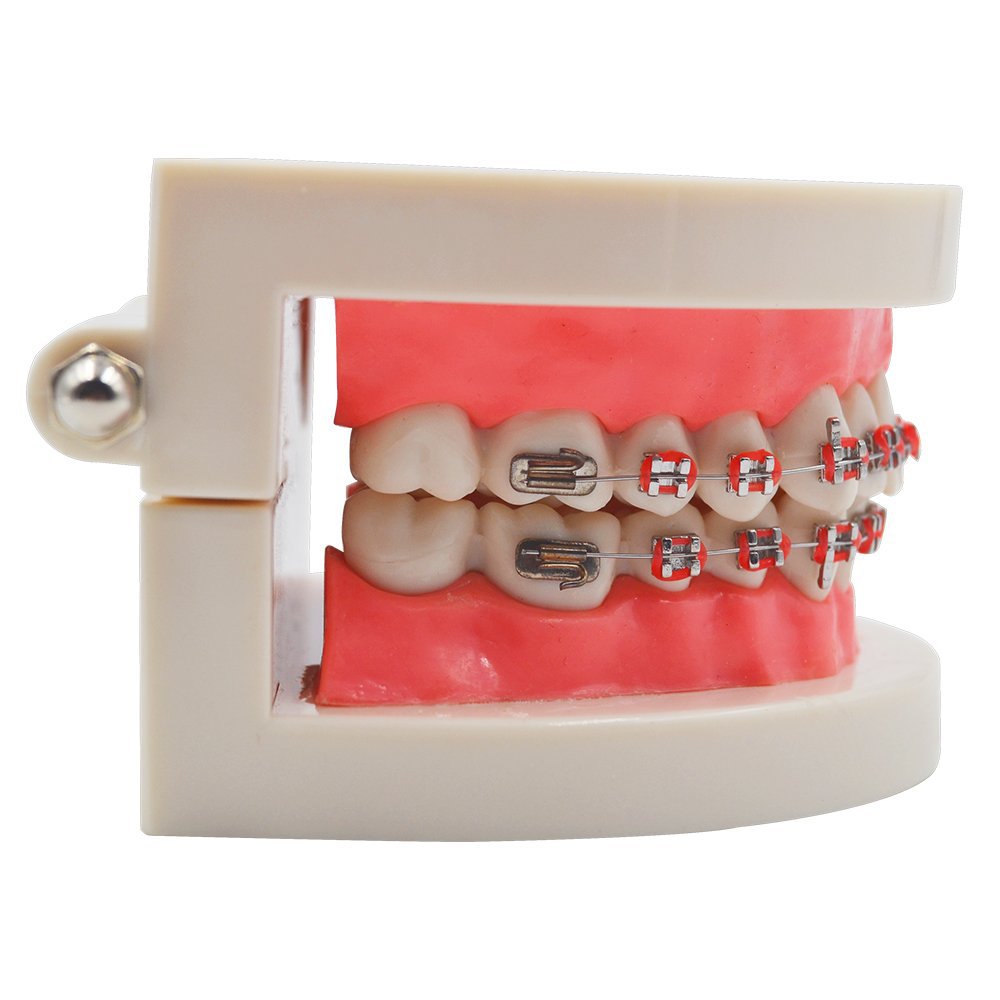 Cross-border exclusive orthodontic models, oral teaching props, color orthodontic models with brackets, dental models Application Scenario
