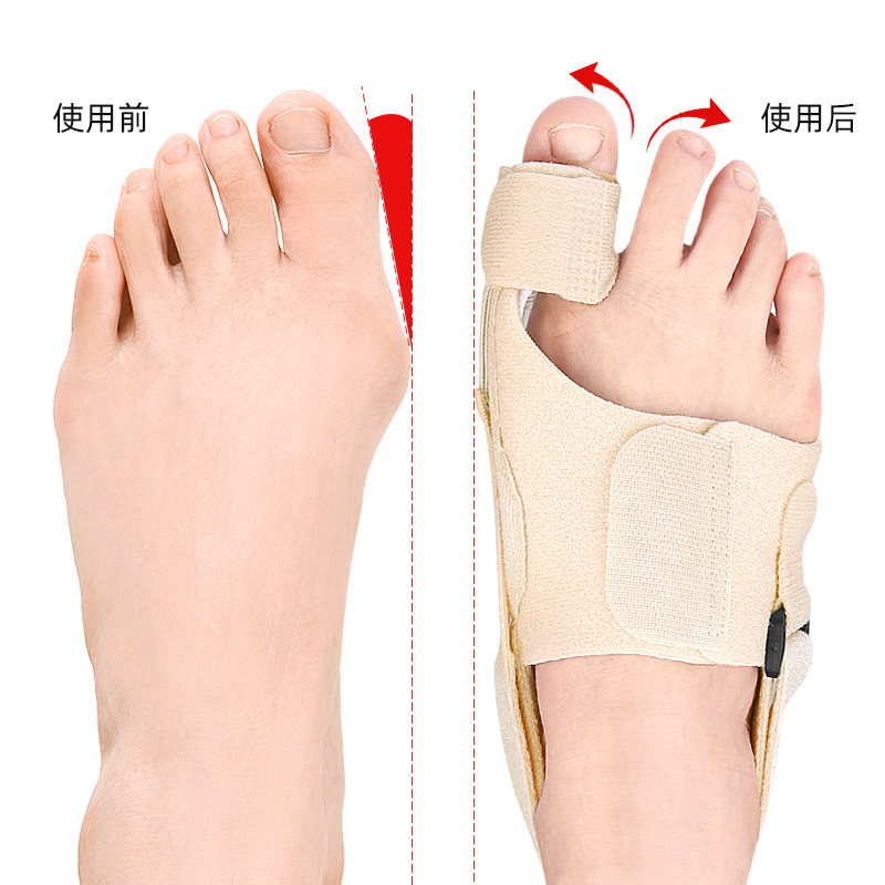Toe fixation with hallux valgus, bigfoot protrusion, overlapping toe separator, adjustable tension foot guard for day and night use details Picture