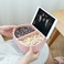 创意塑料果盘懒人带手机支架零食果盘客厅家用宿舍神器带支架果盘产品图