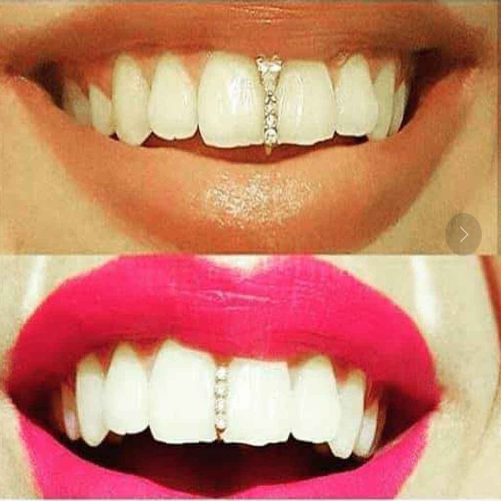 European and American Halloween braces with diamond gold bar braces Hip hop braces single large gold teeth with diamond braces Item Picture