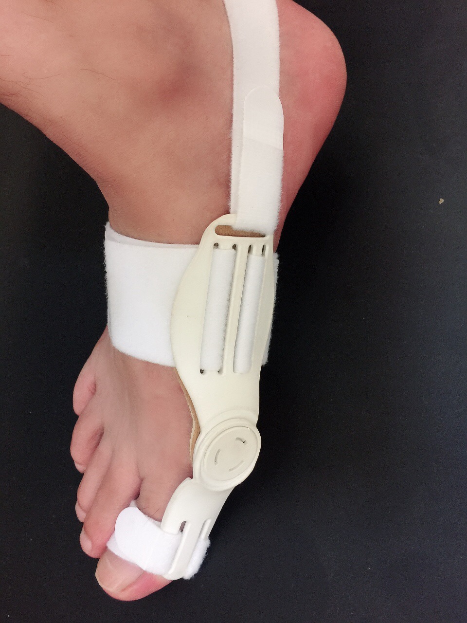 The new 2020 model of big foot bone fixation and improvement device Item Picture