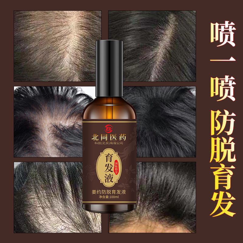 Beitong Medicine hair nourishing liquid hairline nutrient hair densification rapid growth for men and women anti-stripping herbal essence Application Scenario