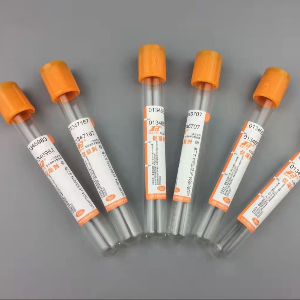 Manufacturer of negative pressure vacuum blood collection tubes, sodium citrate 1:4 coagulation promotion tubes, and general blood routine collection tubes Application Scenario