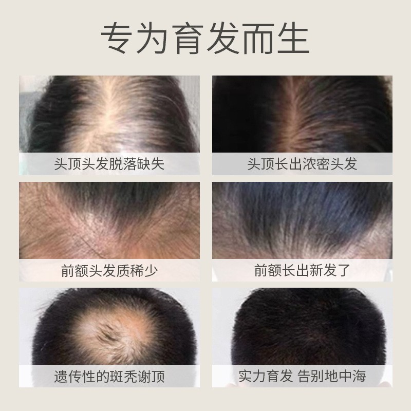 Authentic anti-desiccation Hair Conditioner to increase thick, fluffy hair fast growth of hairline and improve hair quality nutrient solution Application Scenario