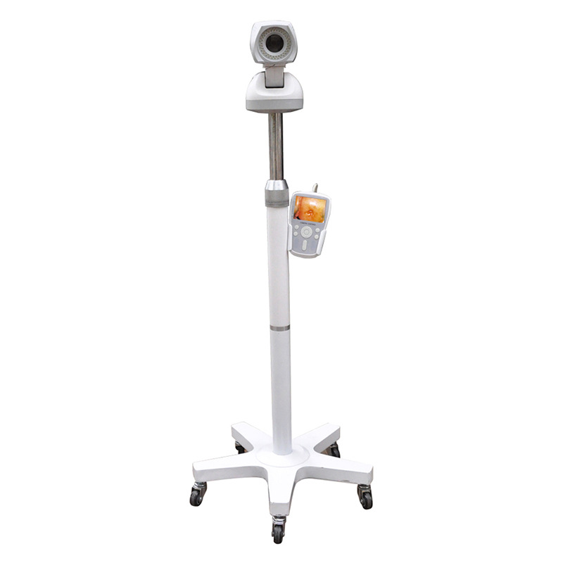 外贸专供便携式Portable Colposcope手持式推车产品图