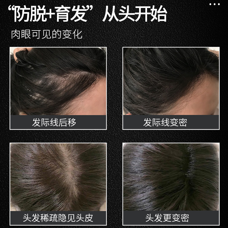 Gingerio ball Massage hair Care Liquid special anti-defoliation hair care Liquid Polygonum multiflorum Orientalis herbal hair care Essence Specification drawing